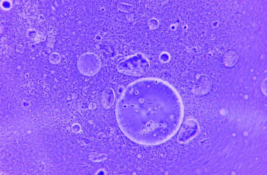 Blue abstract image of water droplets and particles under a microscope.
